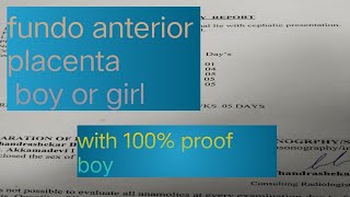 funda anterior placenta means baby boygirl 35 weeks pregnant  genderreveeL scan  baby boy scan [upl. by Prebo]