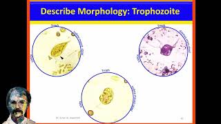 Diagnostic Parasitology Chilomastix mesnili and Dientamoeba fragilis [upl. by Aicala]