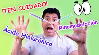 Acido Hialurónico en Rinomodelación [upl. by Norted]