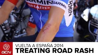 How To Treat Road Rash  Vuelta A España 2014 [upl. by Haimes249]