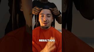 TRENZAS me dejaran Calvo👀 Cambio de Look [upl. by Gusba]