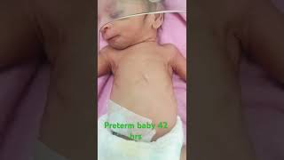 31weeksbabyneonatal newbornbaby cutebaby neonatalogy o2inhalatonbyhoodhospitalcare 1200gram [upl. by Assylla476]