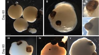 Brain organoid news [upl. by Yllib340]