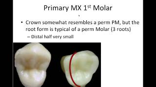 12 PrimaryDeciduous Dentition  NBDE Part 1 Boards Study [upl. by Medin]