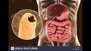 Nématodes transcutanés ankylostomose ancylostoma duodénale necator Americanus 3eme année médecine [upl. by Enirehtahc239]