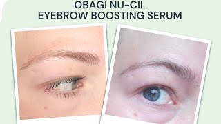 Amazing AtHome Chemical Peel Obagi Blue Peel Radiance Tutorial [upl. by Elleb]