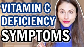 VITAMIN C DEFICIENCY SYMPTOMS DrDrayzday [upl. by Dorthy982]