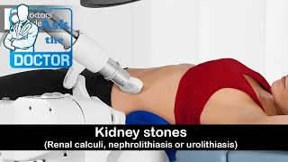 Extracorporeal Shock Wave Lithotripsy ESWL [upl. by Holcomb]