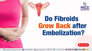 Do Fibroids grow back after Embolization  uterinearteryembolization [upl. by Rubbico]