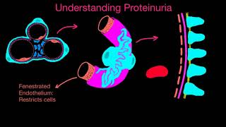 Proteinuria 1 [upl. by Keisling]