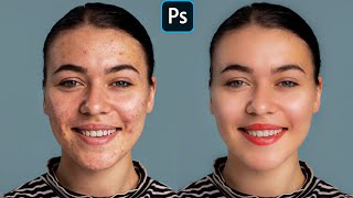 Face Retouching  Best Photoshop Tutorial  Skin Retouching [upl. by Goraud]