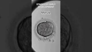 Early development of human  Cleavage  morula  blastulation [upl. by Sharity]