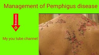 skin disease management of Pemphigus disease [upl. by Inaej]