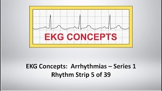 EKG Concepts Arrhythmias Course  Strip 5 of 39 [upl. by Nosemaj]