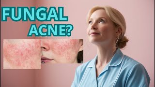 Do YOU have Fungal Acne  Dermatologist Talks Symptoms and Treatments [upl. by Gertrudis]