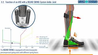 EN The Right Orthosis in case of a Combined Weakness of the Dorsiflexors and Plantar Flexors 34 [upl. by Zilla]