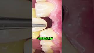 devuelve tus dientes sin desgastar otros dientes dentista tips parati viral fyp shorts [upl. by Arakahs46]