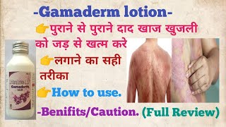 Gamaderm Lotion Lindane Lotionदाद खाज खुजली को जड़ से खत्म करे subscribe how to usevideo short [upl. by Elohc]