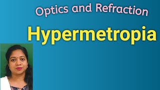 HYPERMETROPIADefinitionOptical diagramMechanismClassificationSymptoms Signs Treatment [upl. by Halik601]