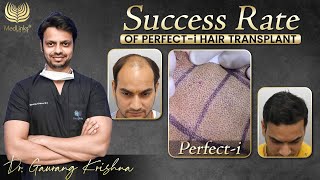 Success Rate of Perfecti Hair Transplant Technique  Best Hair Transplant in India  Medlinks [upl. by Devonna867]