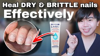 How to HEAL DRY amp BRITTLE NAILS effectively  My nursing interventions [upl. by Angadresma]