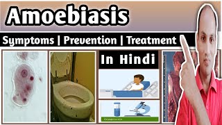 Amoebiasis  Amoebic dysentery  Symptoms  Treatment  Bio  Class 12  Hindi  NEET  Kishor Sir [upl. by Barina]