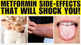 Metformin weird side effects that will shock you [upl. by Neeloj921]