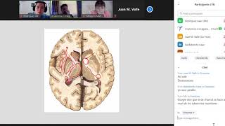 Confg interna de cerebro y cerebelo Marcos y Juan [upl. by Krucik]