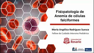 Fisiopatología de Anemia de Células Falciformes Parte 2 de 2 Curso Fisiología UCIP 2021 11 03 [upl. by Androw]