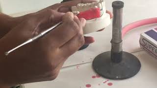 Wax up for Partial Denture [upl. by Tesil]