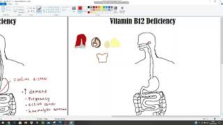 Anaemia The Clinical Picture  Haematinics Deficiencies Part 2  B12 and Folate [upl. by Betsey]