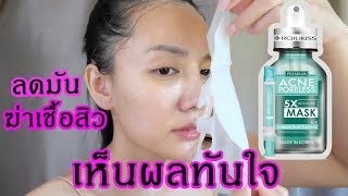 Rojukiss Acne Poreless 5X Intensive Mask มาส์กหน้าโรจูคิส [upl. by Hgielyak931]