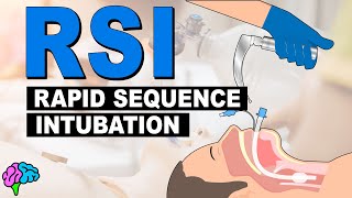 What is Rapid Sequence Intubation RSI [upl. by Wolenik530]