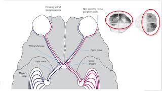 RS Vision Pathway Part 4  Chiasmal Segment [upl. by Crim]