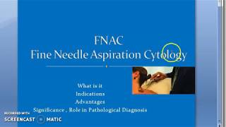 Pathology 918 a FNAC Fine Needle Aspiration Cytology Diagnostic Pathology InterVention [upl. by Akiehs896]