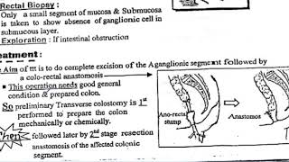 hirschsprung disease  aganglionic megacolon IO P6 [upl. by Aura]