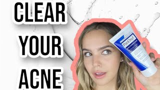 PanOxyl acne foaming face wash detailed review [upl. by Kata]