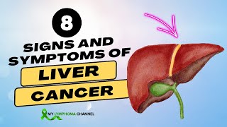 8 Signs and Symptoms of Liver Cancer [upl. by Meakem]