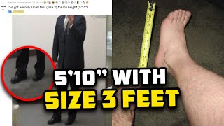 5 Foot 10 Man With Size 3 Feet Seeks Answers [upl. by Eineeuq]