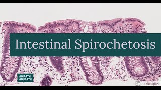 Intestinal Spirochetosis [upl. by Bobbee]