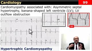 internalmedicine cme usmle محاضراتباطنة ecg كورساتباطنة clinical clinical medicine [upl. by Parsifal]