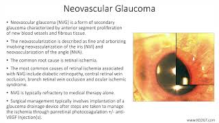 Lecture Neovascular Glaucoma 1 Slide in 5 Minutes [upl. by Pelaga466]