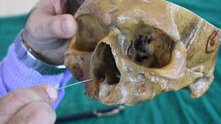 OSTEOLOGY OF NORMA FRONTALIS PART 1 [upl. by Etnom]