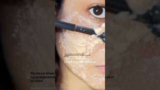 Hyperpigmentation part 3  with just 2 ingredients from your kitchen  Ankita 2024 [upl. by Azirb345]