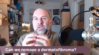 AskJJ Can we remove a dermatofibroma [upl. by Akiret]