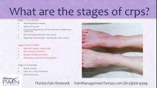 Basics of RSD and CRPS Treatment at Top Tampa Pain Centers 813 6664399 [upl. by Ahsekal]