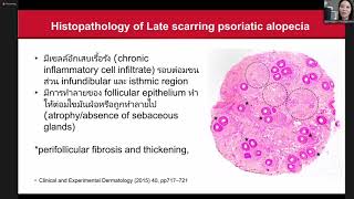 Scalp Psoriasis and Psoriatic alopecia [upl. by Nagaem]