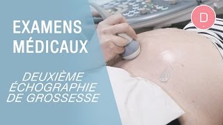 La 2e échographie de grossesse  Examens grossesse [upl. by Stilwell870]