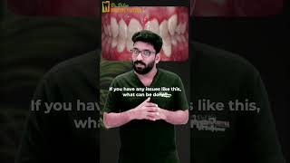 WHITE SPOT LESIONS CAUSES AND SOLUTIONS  Dr Dilipkumar [upl. by Annaer]