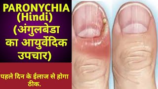 Paronychia finger nail infection in Hindi  पेरोनिसिया नाखूनों का संक्रमण  अंगुलबेडा घरेलू उपचार [upl. by Jaclyn253]